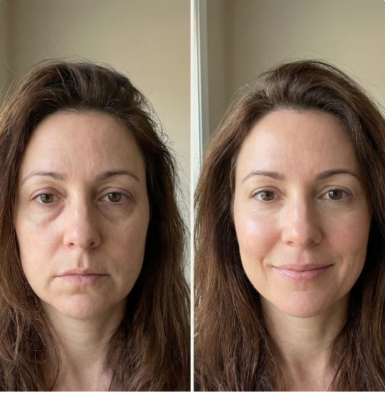 BeauBrush Cepillo Facial Limfático