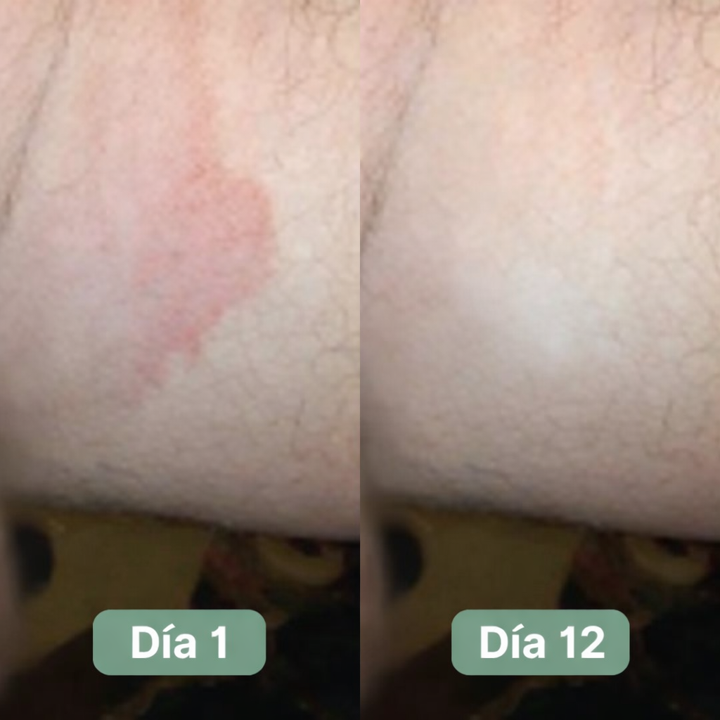 DermaPure Jabón Antihongos